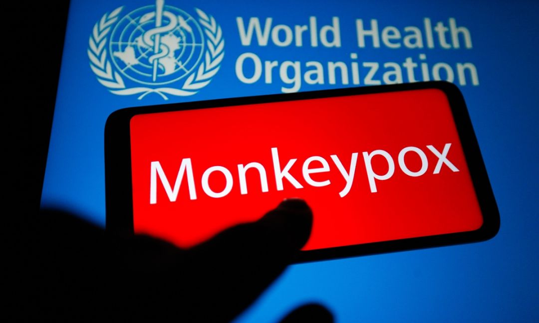 Masih Epidemi Corona, China Siap Uji Cacar Monyet-Image-1