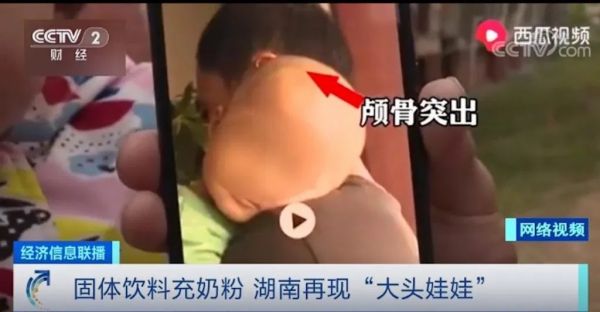 Hati-hati, Susu Bubuk Palsu Ini Sebabkan Kepala Bayi Membesar di Hunan!-Image-2