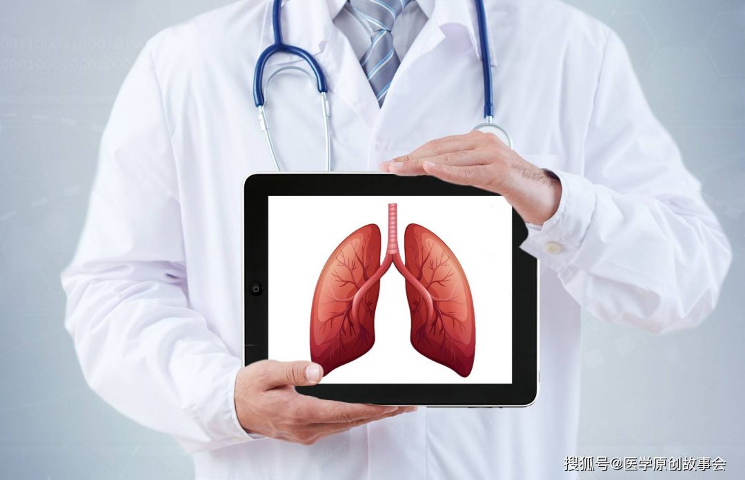 4 Tips Dalam Mencegah Kanker Paru-paru-Image-1