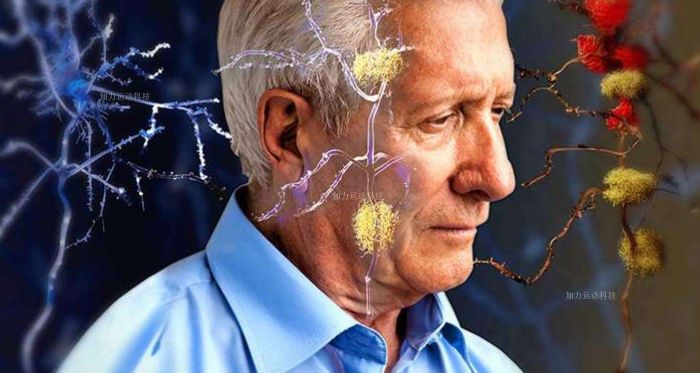 Perawatan Mulut Sangat Penting Untuk Mencegah Penyakit Alzheimer-Image-1