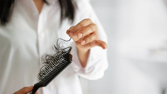 Ini Penyebab dan Cara Mengatasi Kerontokan Rambut Dini-Image-1