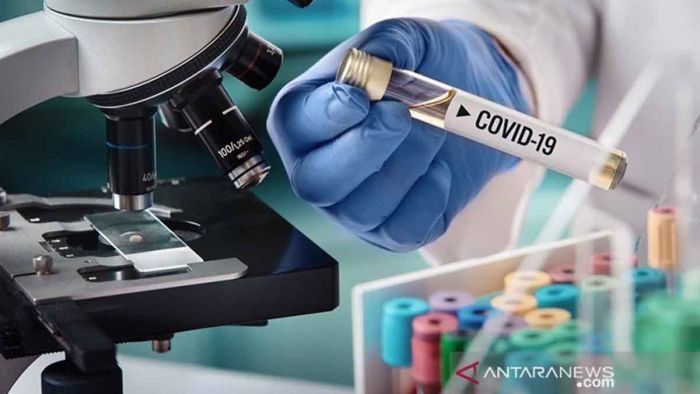 Vaksin COVID-19 Tiongkok Diprediksi Siap Produksi Akhir Tahun 2020-Image-1